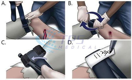 Tournquiet TPS TT01 Instruction of use